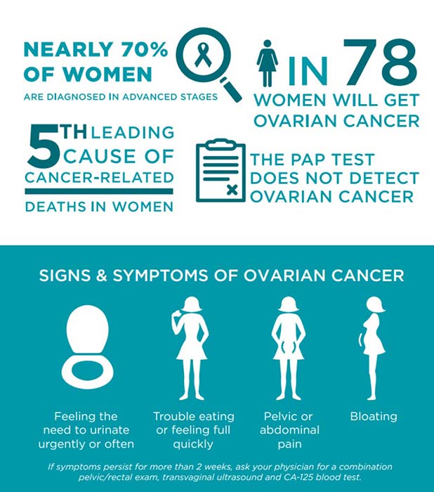 Signs of ovarian cancer