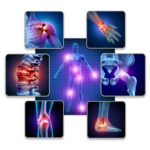 Illustration of joints affected by osteoarthritis, including the shoulder, hand, spine, hip, knee and ankle